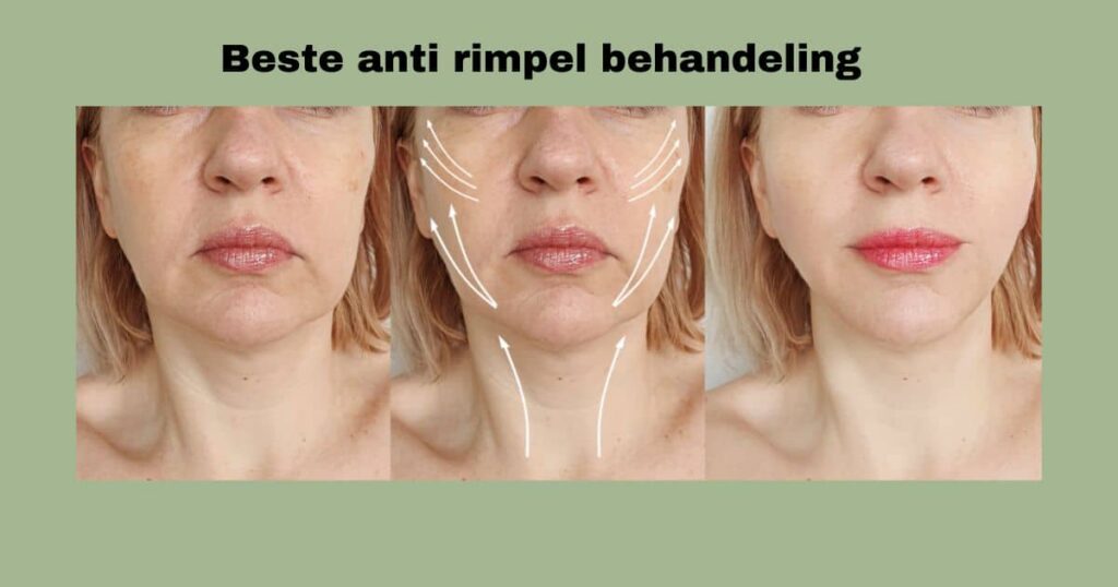 anti rimpel crème die echt werkt